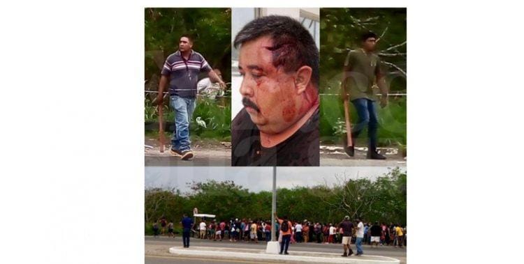 Por lesiones denuncian a candidato de Morena a la Alcaldía de Cd. Madero